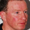 Micky Ward